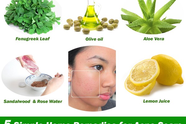 600x400xFive simple and effective home remedies for acne scars 600x400.jpg.pagespeed.ic. HXjxbPax PPWwySN m