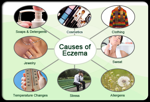 Eczema atopic dermatitis s3 causes of eczema
