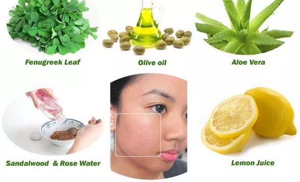 Home Remedies for Acne Scars