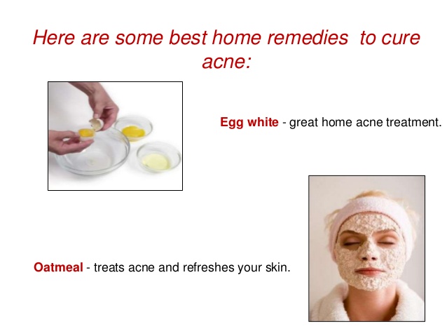 best proven home remedies for acne 6 638